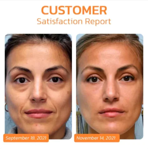 Intensive Hydrating Collagen Eye Masks | Under-Eye Treatment for a Youthful Glow