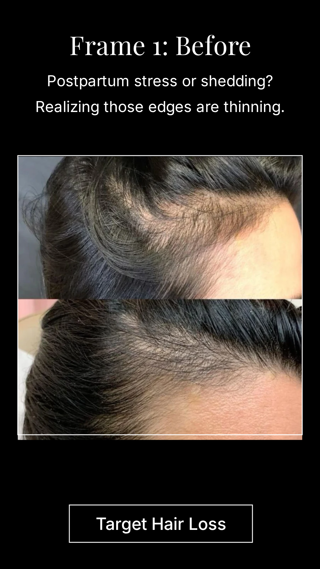 The PinkPatta 3-Step Hair Growth Routine: A Natural Solution for Stronger, Healthier Hair