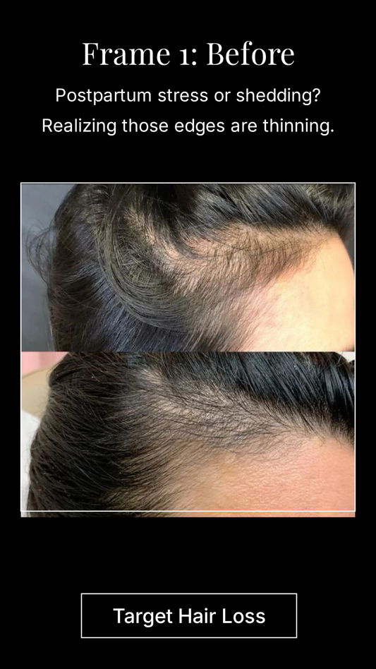 The PinkPatta 3-Step Hair Growth Routine: A Natural Solution for Stronger, Healthier Hair