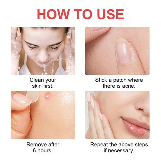 Hydrocolloid Invisible Acne Patch
